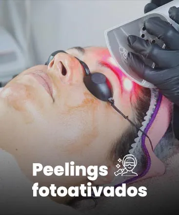 Peelings Fotobiomodulados
